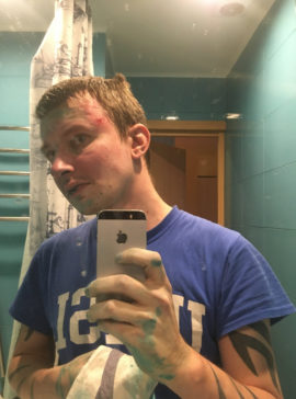 Russian Investigative Journalist Says He Was Attacked in Moscow