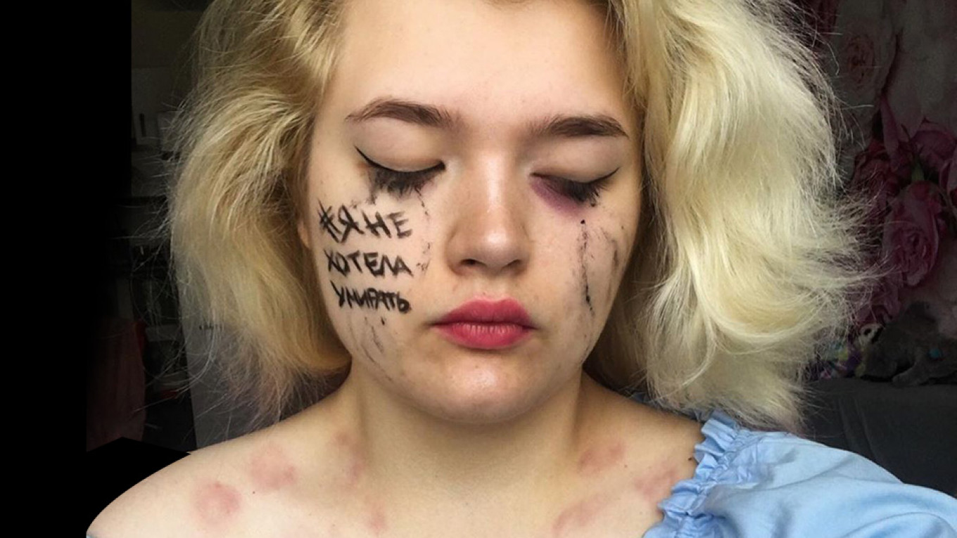 Russian Women Post Bruised Selfies to Push for Domestic Violence Law